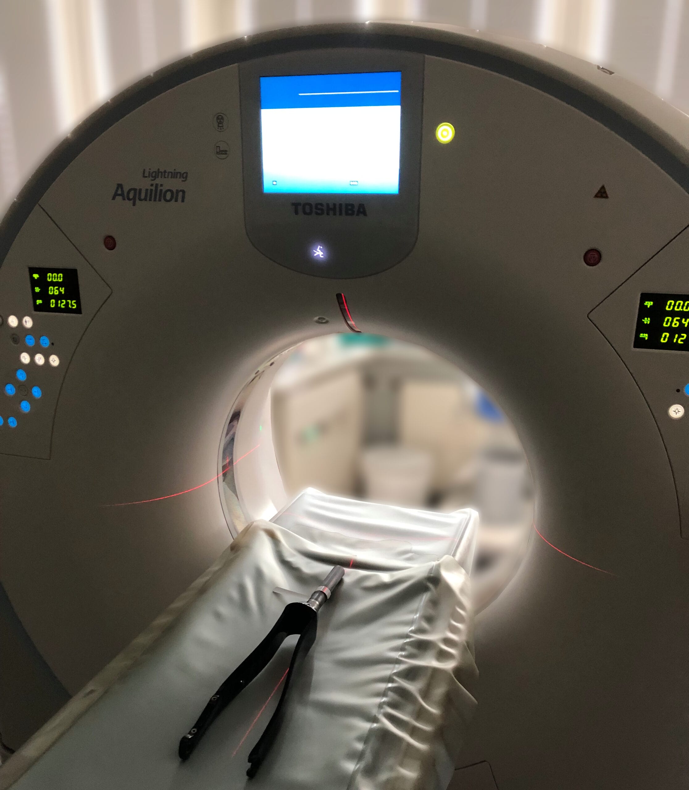 Computertomographie zur Identifikation von Produktionsfehlern bei Versagen ohne Sturzgeschehen